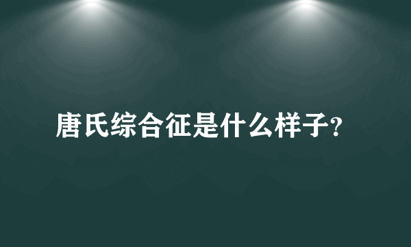 唐氏综合征是什么样子？