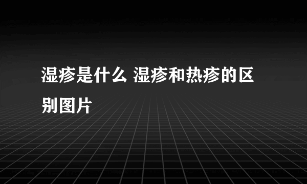 湿疹是什么 湿疹和热疹的区别图片