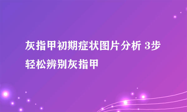 灰指甲初期症状图片分析 3步轻松辨别灰指甲